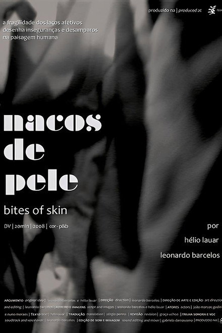 Nacos de pele