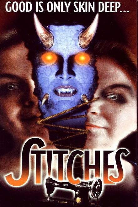 Stitches