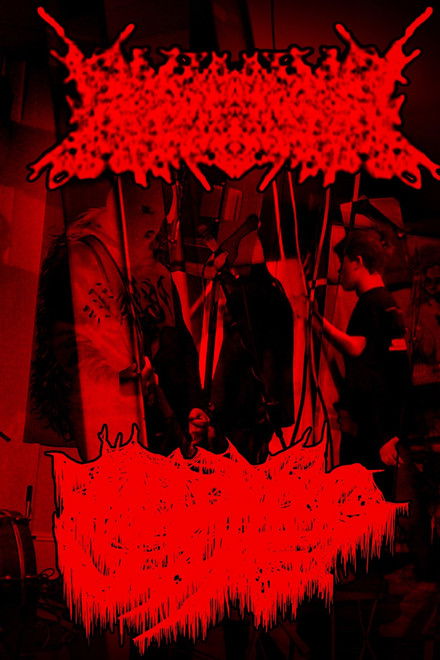 Rhabdomyolysis/Amebiasis Live at The Veil