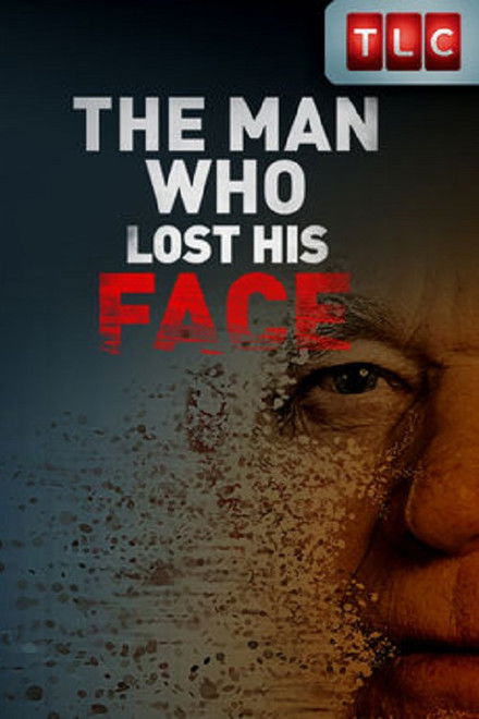 The Man Who Lost His Face