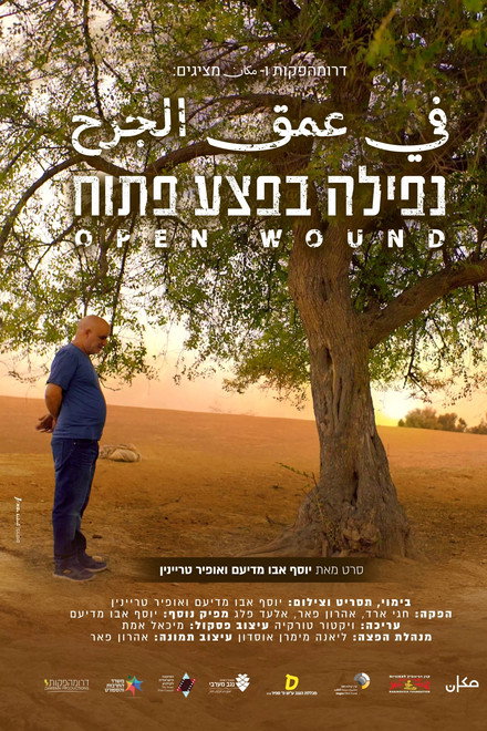 Open Wound