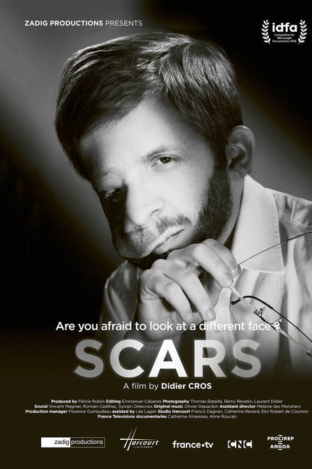 Scars