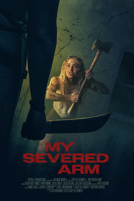 My Severed Arm
